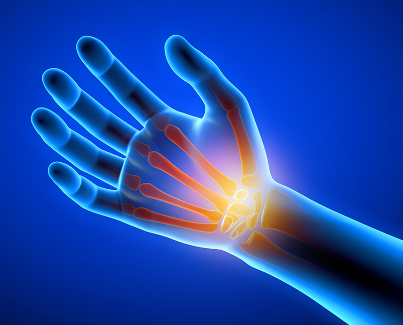 Hand and Wrist Conditions