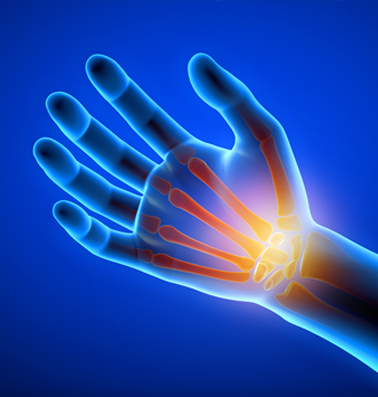 Hand & Wrist Conditions