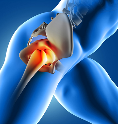 Hip Conditions
