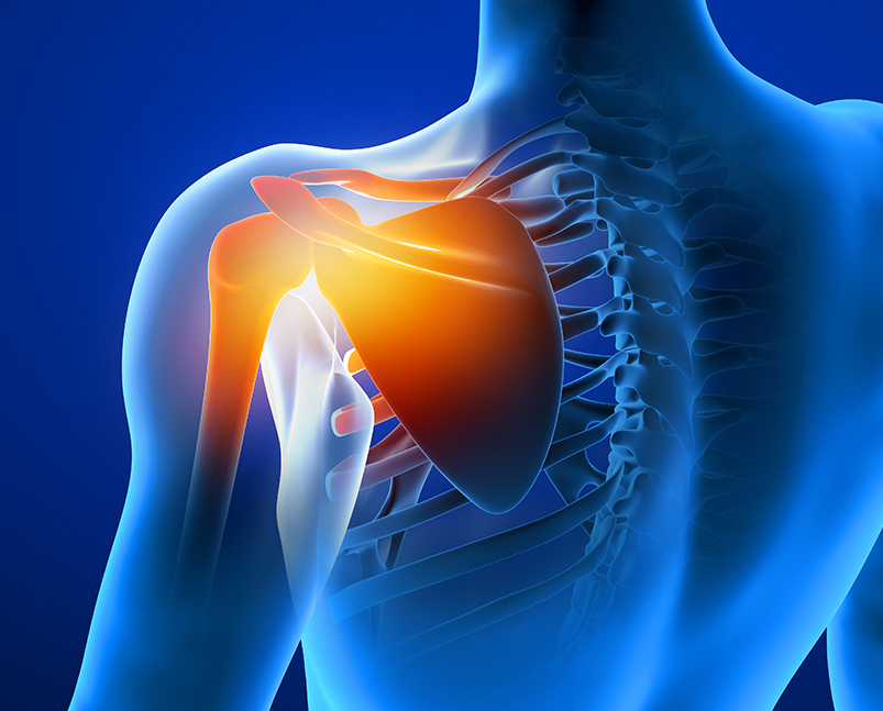 Shoulder Conditions