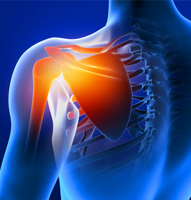 Shoulder Conditions