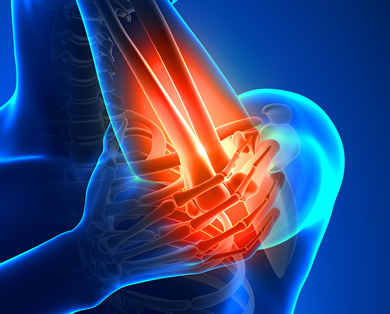 Upper Limb Conditions