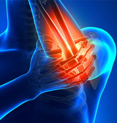 Upper Limb Conditions